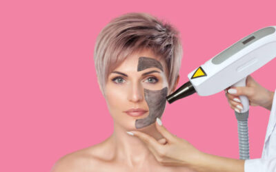 Does Laser Carbon Peeling Even Out Skin Tone?