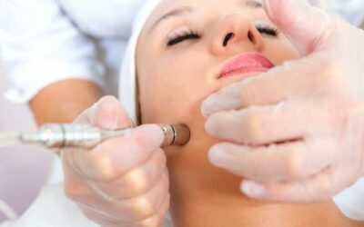Does Microdermabrasion Treatment Improve Texture