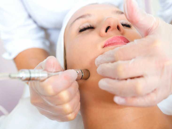 Does Microdermabrasion Treatment Improve Texture