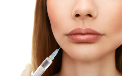 Does Russian Lip Fillers Add Height to Lips?