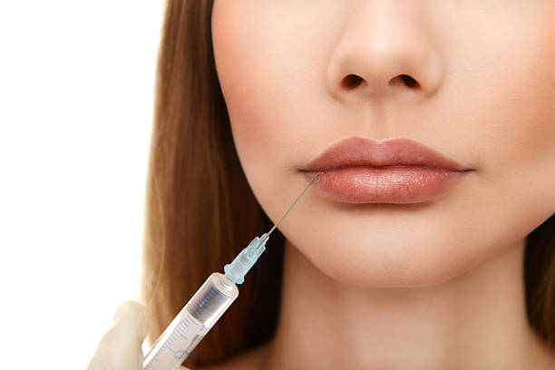 Does Russian Lip Fillers Add Height to Lips
