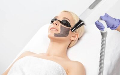 Get a Hollywood Glow with Laser Carbon Peel