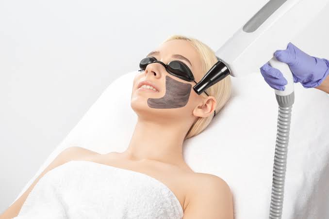 Get a Hollywood Glow with Laser Carbon Peel