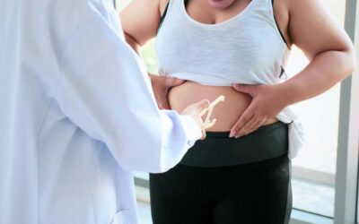 How Does Gastric Botox Control Hunger?