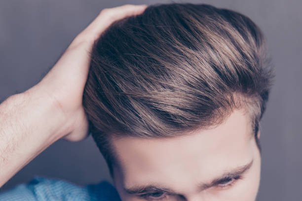 How Permanent Is Hair Transplant for Hair Growth?