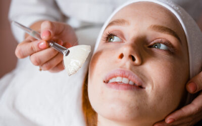 How Safe Is Chemical Peel for All Skin Types?