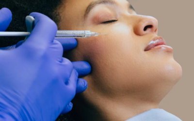 Is Botox the Right Anti-Aging Treatment?