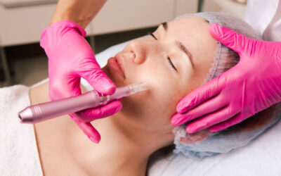 Is Dermapen Treatment Effective for Pigmentation?