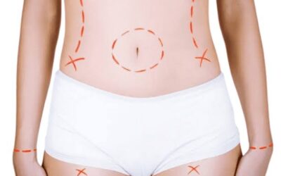 Mommy Makeover Dubai Cost: A Complete Pricing Guide