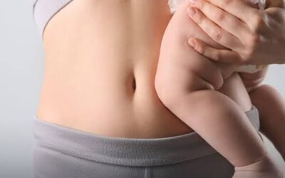 Mommy Makeover Dubai: The Ideal Timeline After Pregnancy