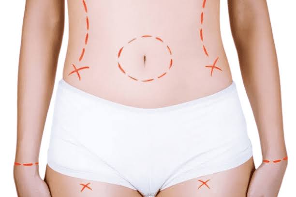 Mommy Makeover Dubai Cost: A Complete Pricing Guide