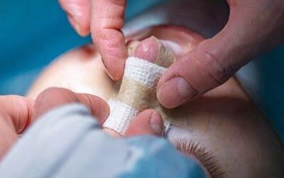 دليلك المتكامل للحصول على أفضل إطلالة من خلال تجميل الأنف في دبي في عيادة تجميل دبي