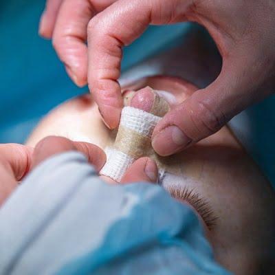 دليلك المتكامل للحصول على أفضل إطلالة من خلال تجميل الأنف في دبي في عيادة تجميل دبي