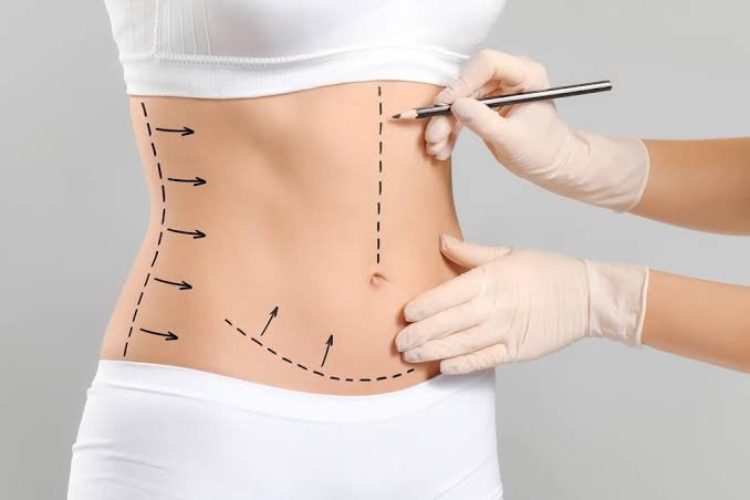 Lipo abdominoplasty in Abu Dhabi