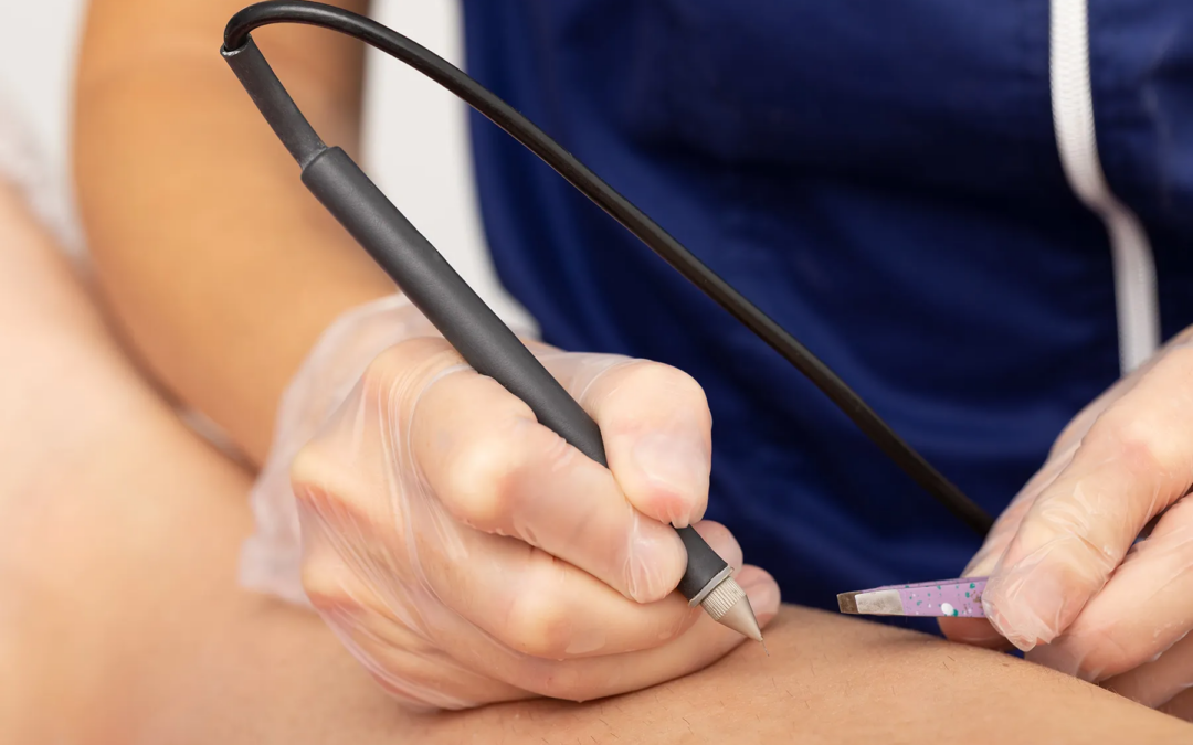 Electrolysis Abu Dhabi