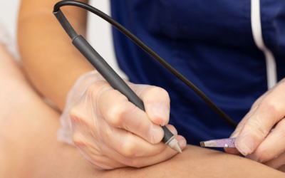 What Results Can You Expect from Electrolysis?