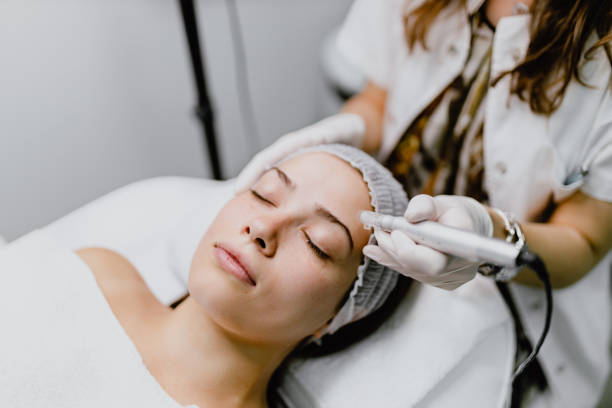 Microneedling for Acne Scars Abu Dhabi