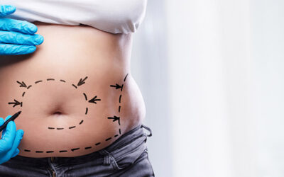 Getting Your Glow Back: Skin Recovery at Mommy Makeover Lounge