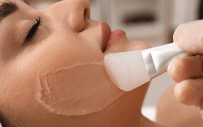التخلص من ندوب العمر: دليل علاج التقشير الكيميائي في دبي لآثار الحبوب في عيادة تجميل دبي