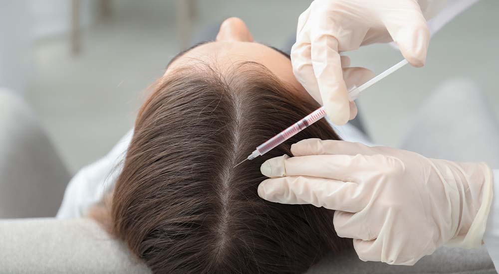 PRP Hair Treatment in Abu Dhabi