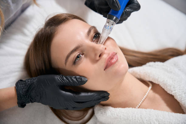 How Does Microneedling Stimulate Collagen Growth