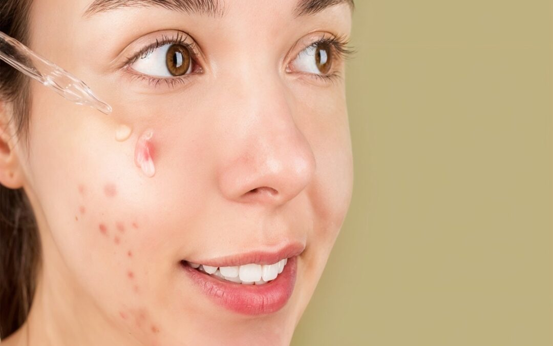 Pigmentation Treatment in Abu Dhabi